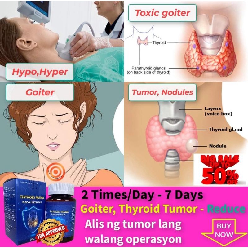 Thyroid Mana Tablets Remove Thyroid Cancer Tumor Goiter Shopee