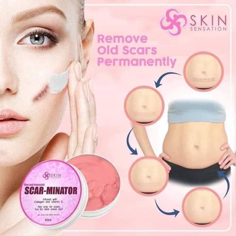 Scar Minator Cream By Skin Sensation The Best Peklat Remover Even Old