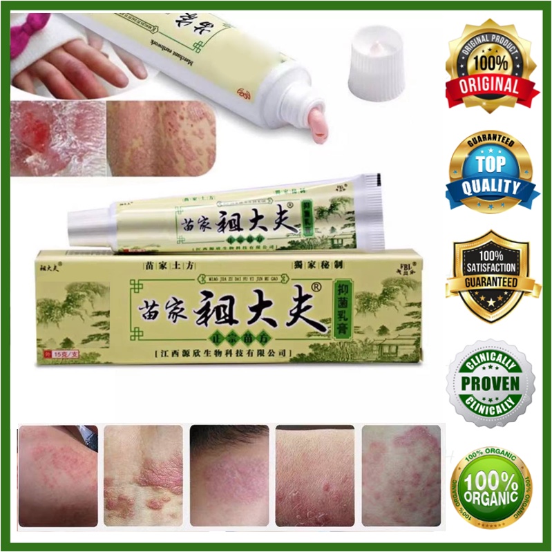 BIGSALE 15g MiaoJia Zudaifu Skin Herbal Psoriasis Dermatitis Eczema