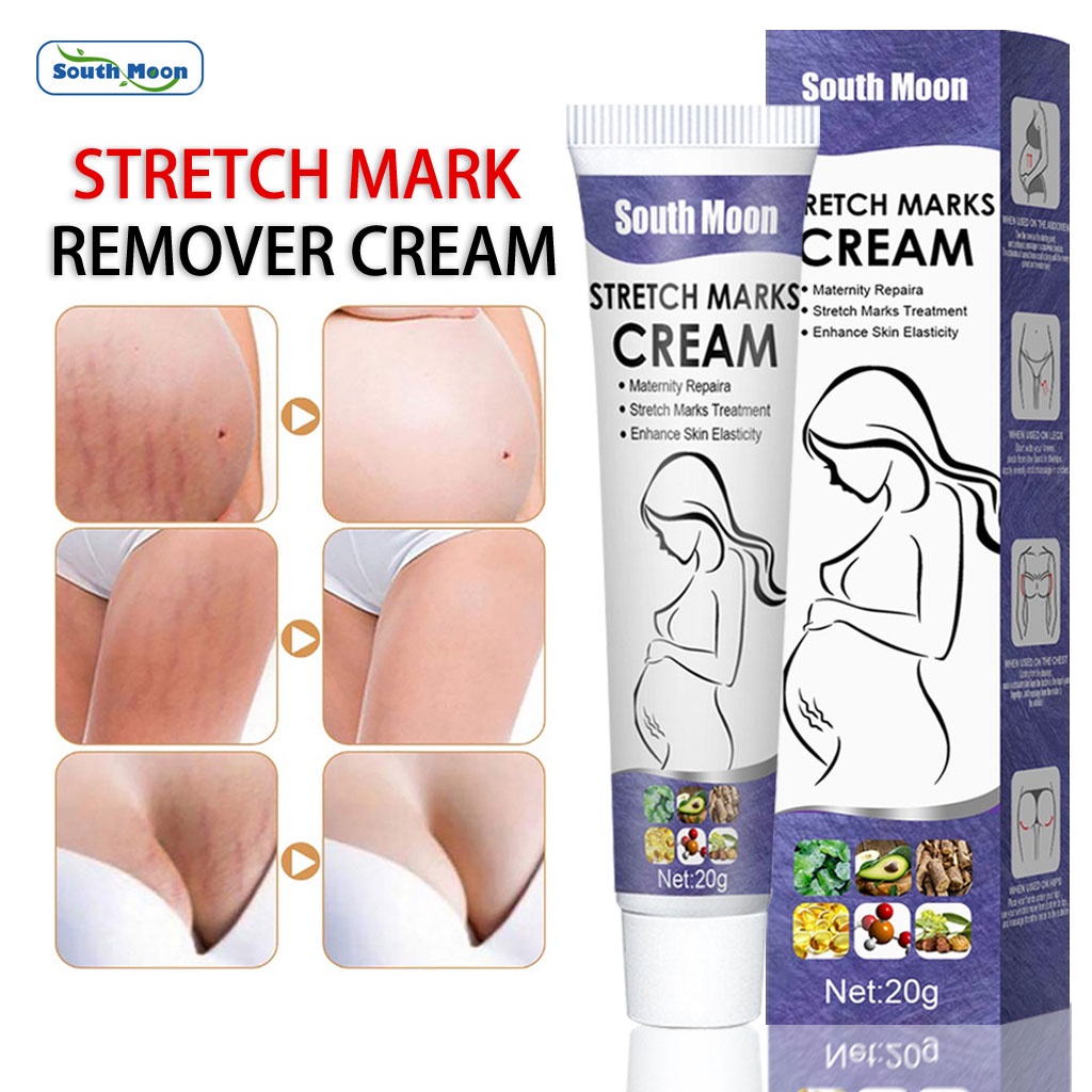 South Moon Stretch Mark Repair Cream Skin Care Scar Removing Cream