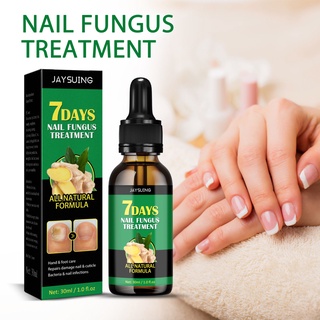 Jaysuing Ginger Nail Care 7 Days Fungal Treatment Feet Care Essence