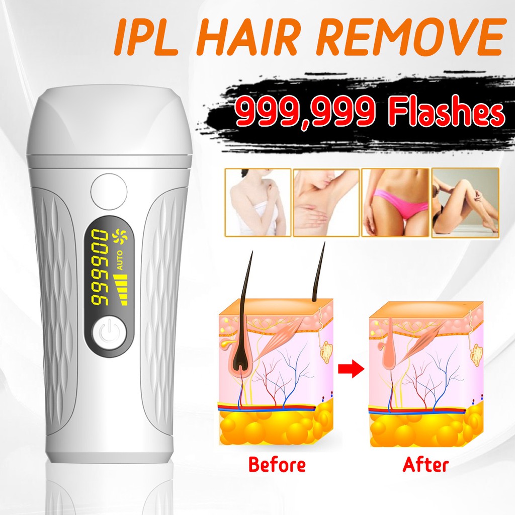 Hot Laser Hair Removal Device Epilator Permanent Electric 3 In 1 IPL