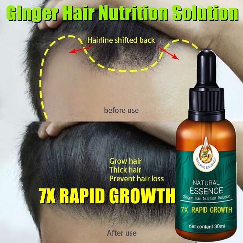 Ginger Hair Growth Essential Oil Rapid Hair Growth Serum Anti Hair Loss