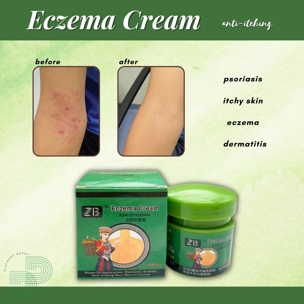 Eczema Cream Psoriasis Treatment Itchy Skin Ointment Antibacterial