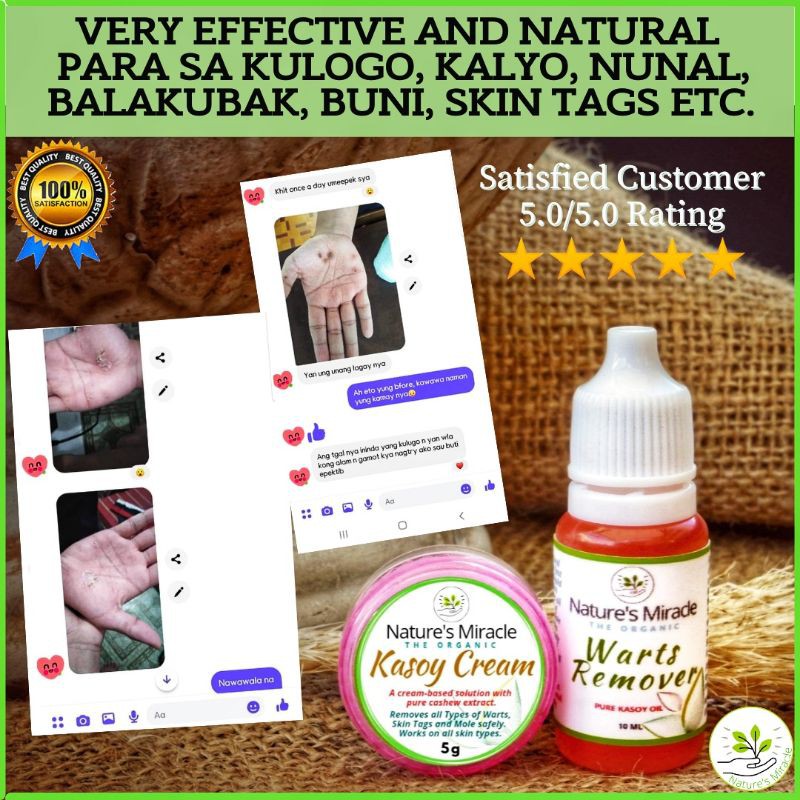 Effective Pure Kasoy Oil For Warts Kulogo Mole Skin Tag Genital Warts