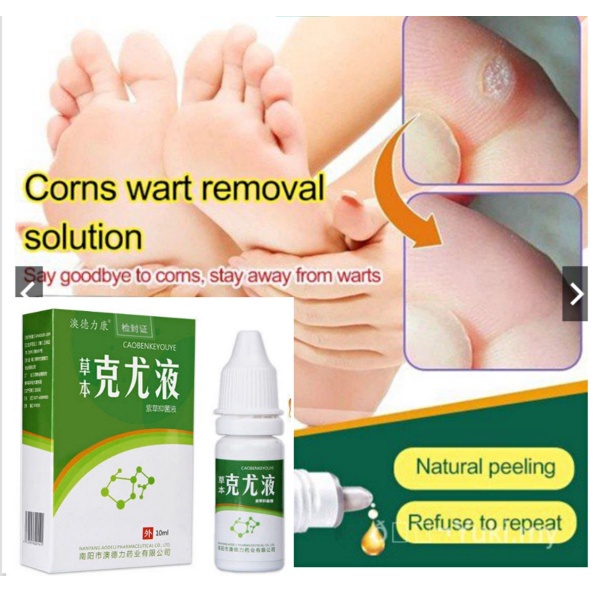 10ML Effective Warts Remover Liquid Remove Mole Skin Tags Get Rid Of