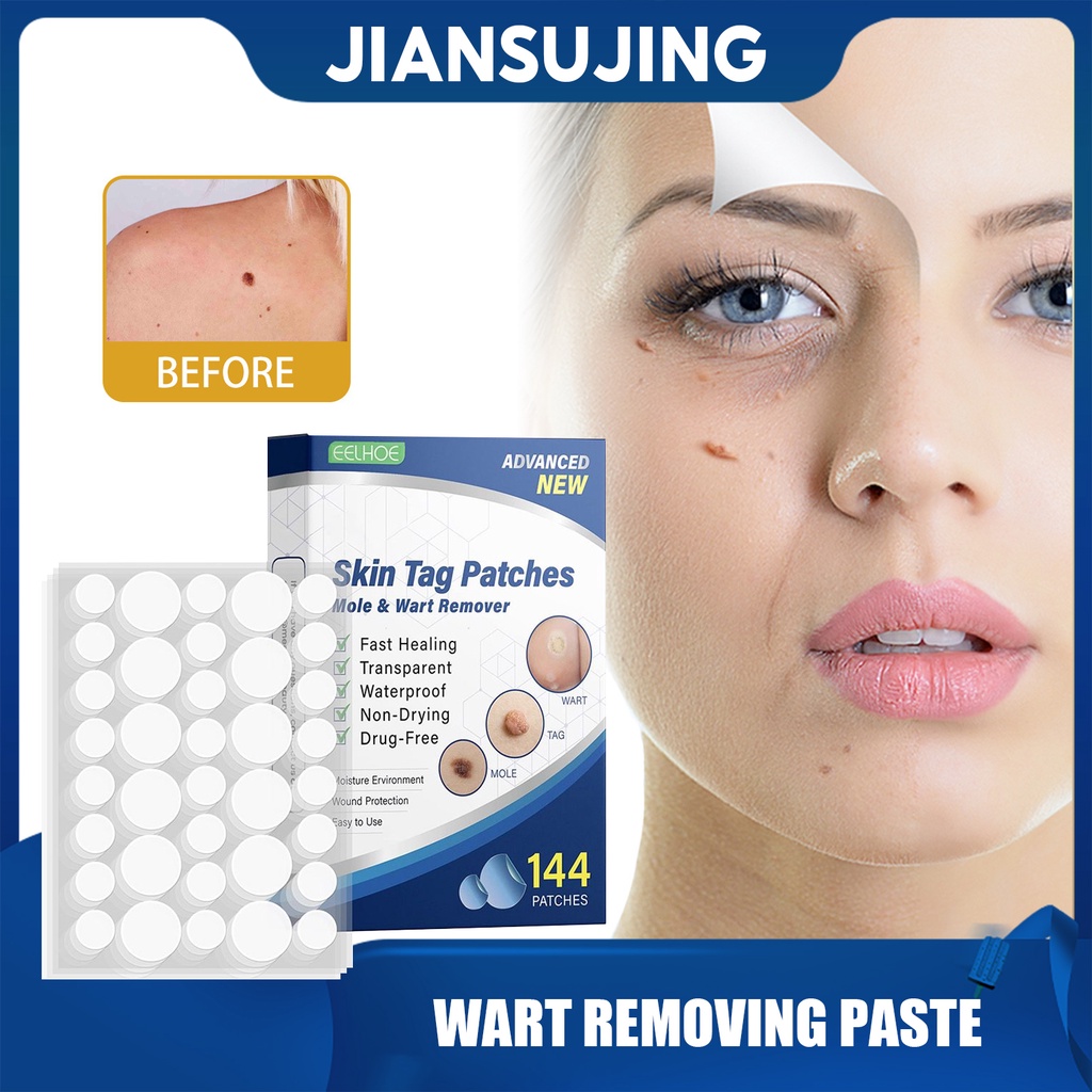 Eelhoe Wart Removal Patch Suitable For Finger And Toe Sole Remover