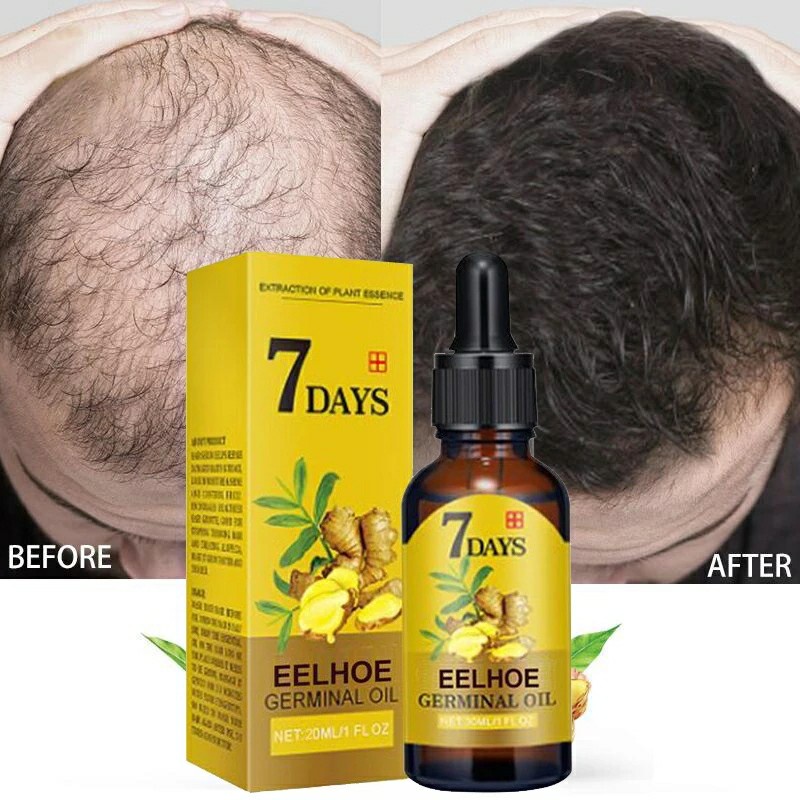 Hair Growth Products Ginger Fast Growing Hair Essential Oil Beauty Care