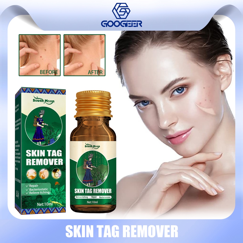 South Moon Skin Tag Remove Liquid Treatment Papillomas Removal Of Warts