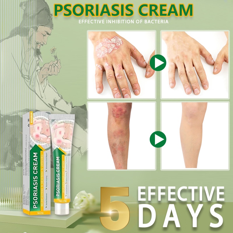 atoderma cream original ointment for itchy skin and allergy bioderm ointment eczema treatment