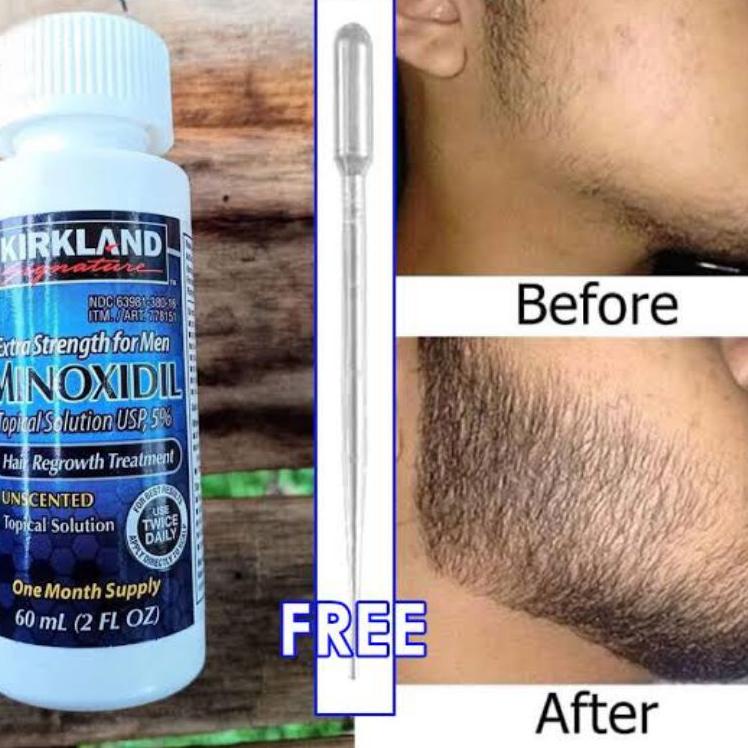 (MoB) Kirkland Minoxidil 100 Original Minoxidil 5 by Costco