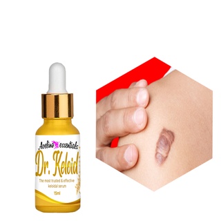 BEST SELLER DR. KELOID scar and keloid remover , keloid scar remover original , keloids removal orig
