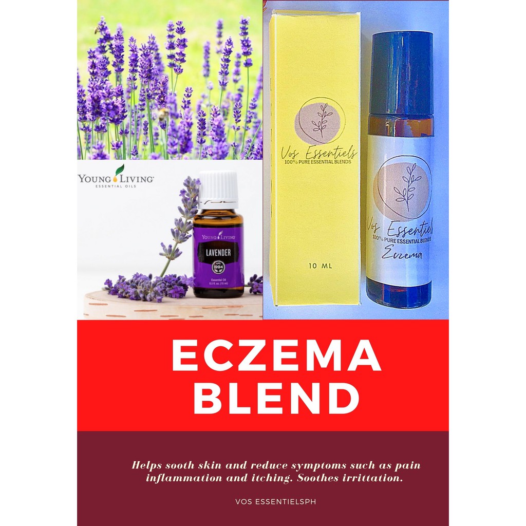 YOUNG LIVING Essential Oil Eczema Blend Shopee Philippines