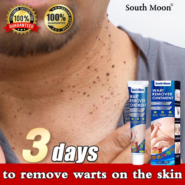 warts-remover-original-cream-warts-removal-organica-mole-kasoy-oil