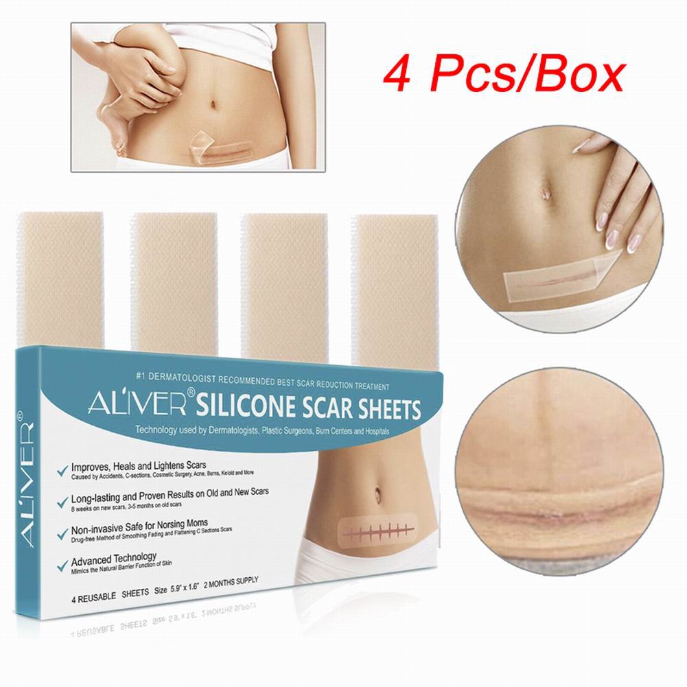 keloid silicone gel sheets