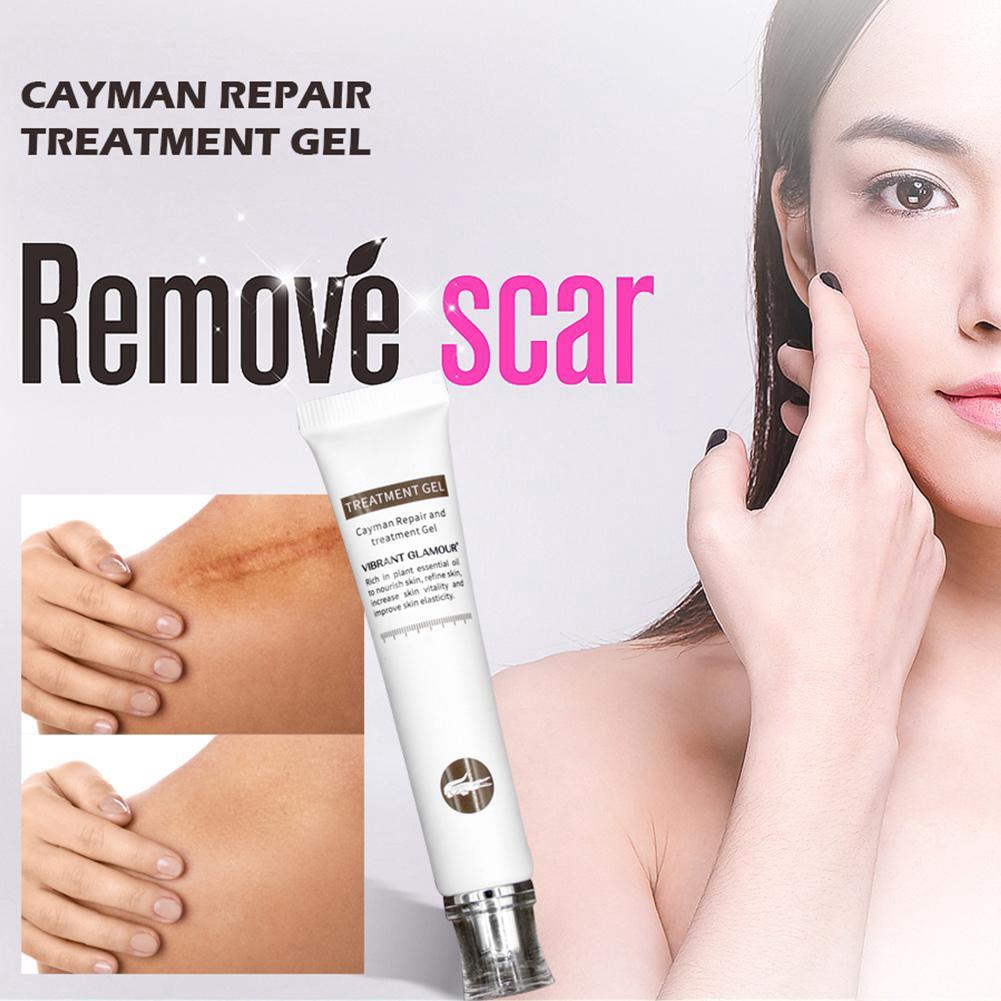 scar-removal-cream-acne-treatment-scar-repair-gel-shopee-philippines