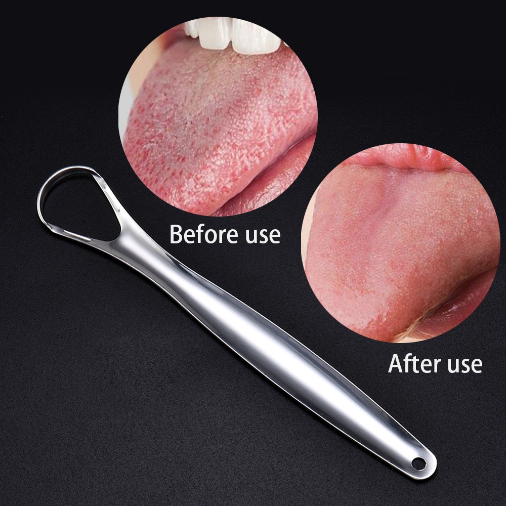 Stainless Steel Tongue Cleaner Scraper Oral Care Bad Breath Sweeper ...