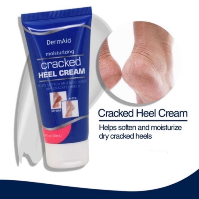 moisturizer for cracked heels
