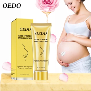 OEDO Rose Remove Stretch Marks Cream Anti Wrinkle Anti Aging Maternity Skin Repair Remove Pregnancy Scars Treatment Body Skin Care 40g #8