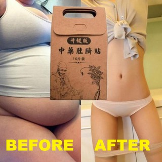 10PCS Slimming Patch Fast Effective Natural Chinese Herbal Weight Losing Fat Burning Detox