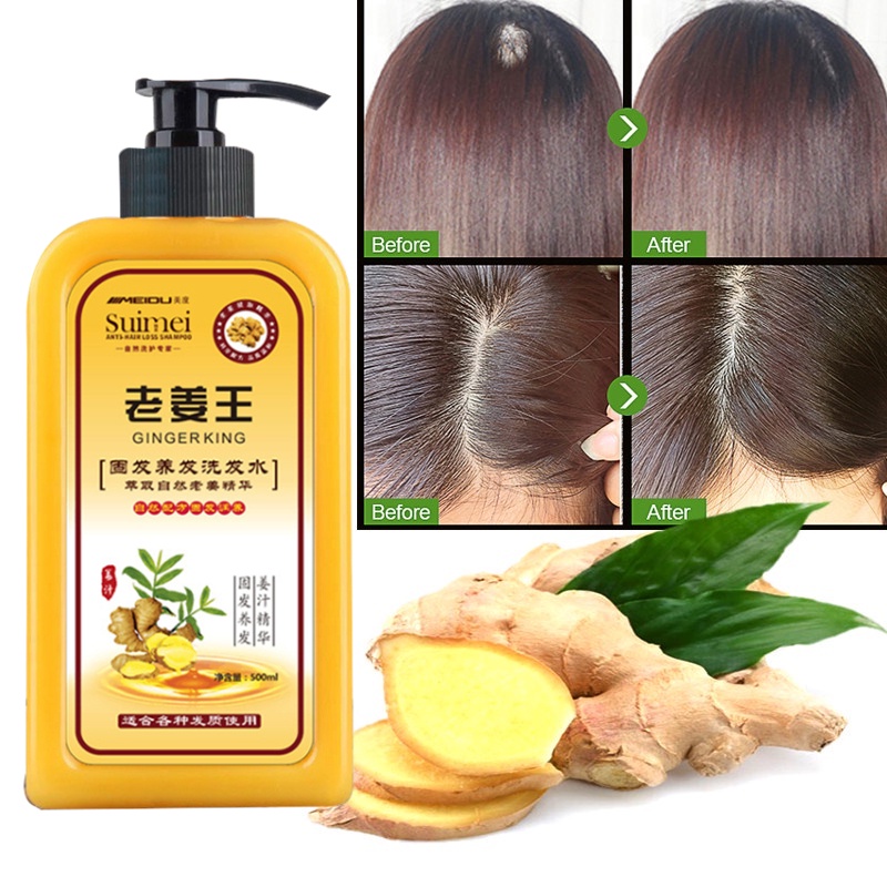 Original ginger shampoo Anti Hair Loss ginger hair care shampoo Oil Control Hair  Growth shampoo | Shopee Philippines