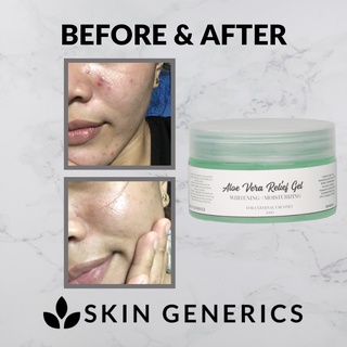 [ ALOE VERA WHITENING GEL ] SkinGenerics Aloe Vera Gel Skin Care Whitening Moisturizer Scar Remover #4