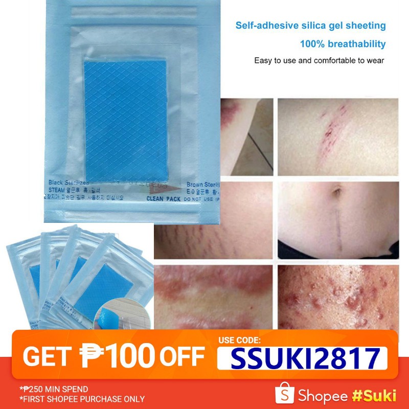 where to buy silicone sheets for scars