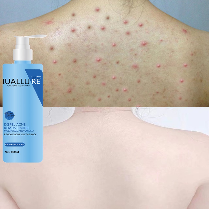 anti mite shower gel