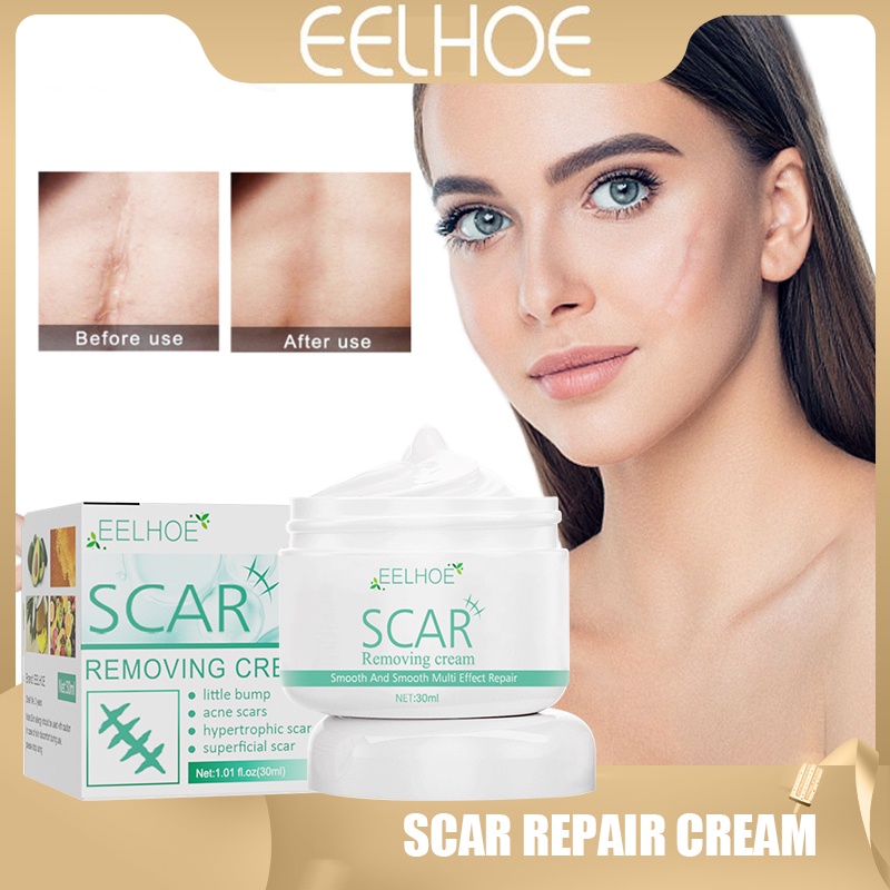 EELHOE Scar Repair Cream Remove Salt Burns Scars Treat Body Old Gel
