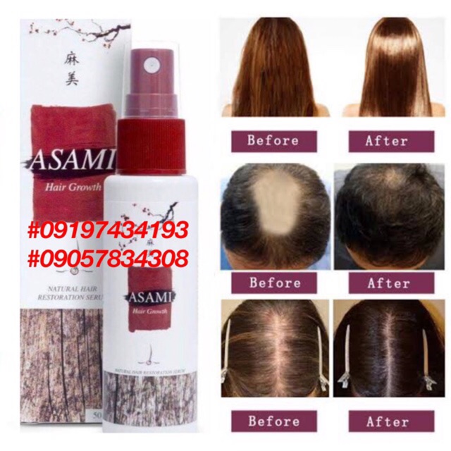 Cod Asami Hair Growth For Men And Women Shopee Philippines