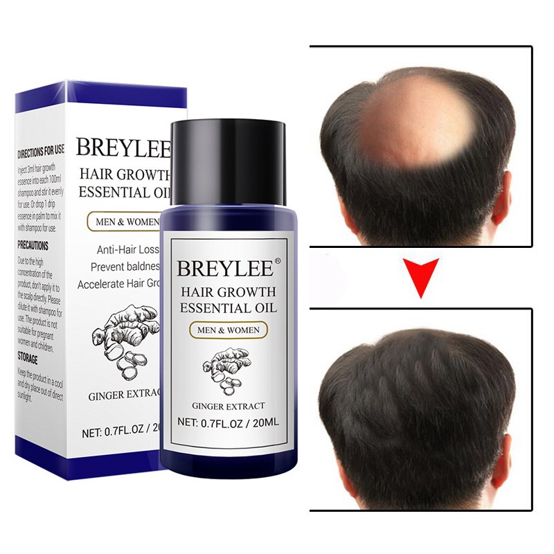 BREYLEE Hair Growth Essential Oil Fast Powerful Hair Products Hair Care  Anti-Hair Loss Serum | Shopee Philippines