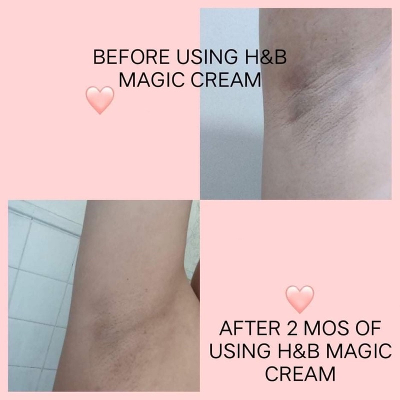 Magic Cream Underarm Whitening by Hope and Beauty