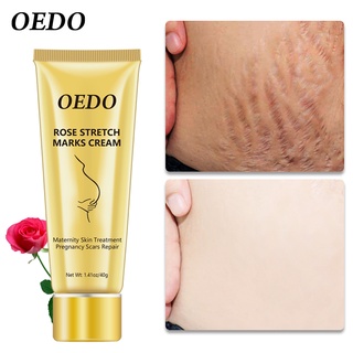 OEDO Rose Remove Stretch Marks Cream Anti Wrinkle Anti Aging Maternity Skin Repair Remove Pregnancy Scars Treatment Body Skin Care 40g #3