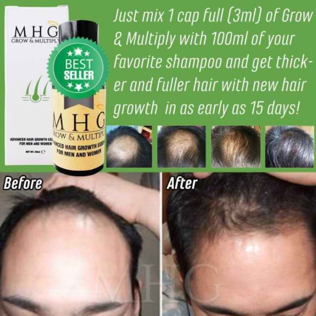 Cod Grab Lbc Bae Mhg Grow And Multiply Hair Regrow Shopee