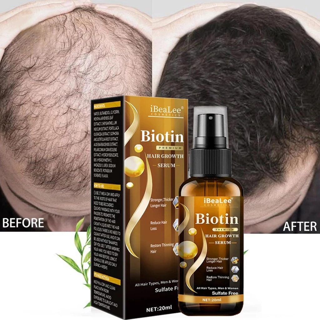 Biotin Hair Growth Products Fast Growing Hair Essential Oil Hair Care  Prevent Hair Loss Scalp Treatment For Men Women | Shopee Philippines