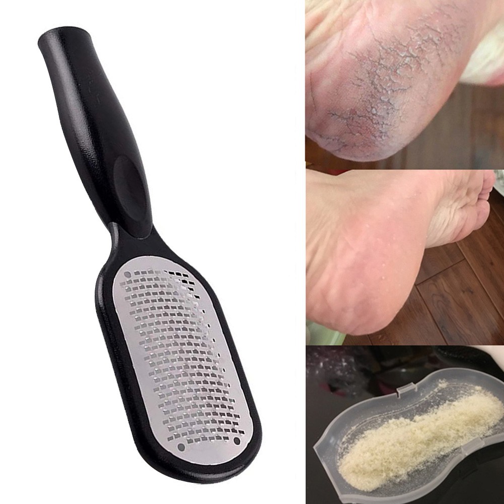 Foot Rasp Care Callus Feet File Hard Skin Remover Exfoliating Pedicure Tool Shopee Philippines