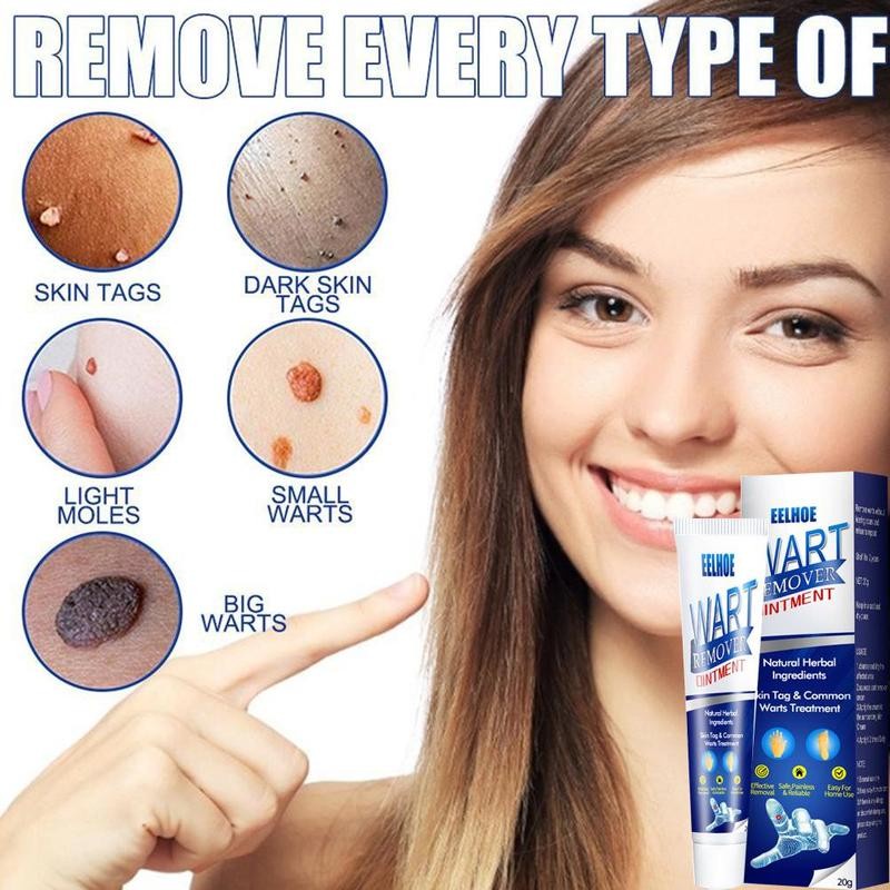 Warts Remover Original Cream Wart Removal Ointment Wart Treatment Skin Tags Mole Remover Cream