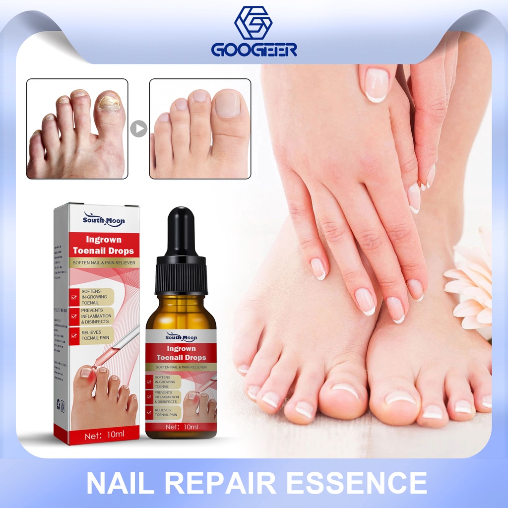 South Moon Ingrown Toenail Drops Soften Nail Pain Reliever Nail Fungal ...