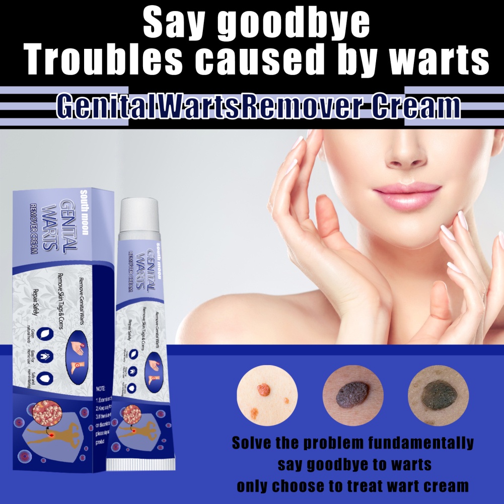South Moon Skin Tag Remover Wart Cream Gram Wart Cream Skin Wart Warts Flat Corn Ointment Flat