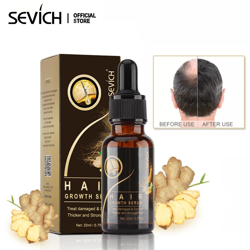 SEVICH Ginger Hair Growth Serum Anti-Hair Loss Essence 20ml | Shopee ...