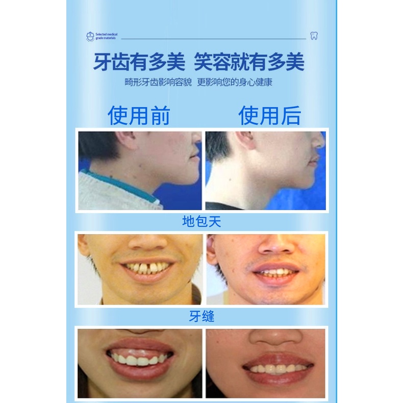 Focus on orthodontics, braces and invisible students, adult tiger