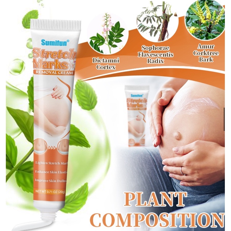 Stretch mark repair cream removes scars improves dull skin ointment pregnant women skin repair care fatty streaks