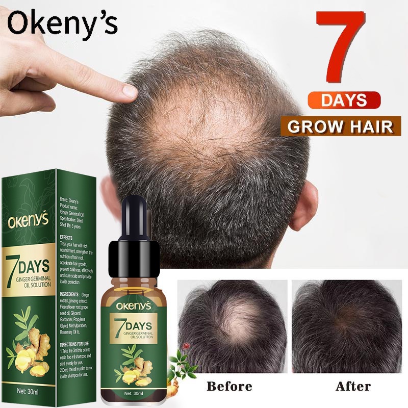 Okey Hair Growth Spray Serum Fast Hair Growth Extract Anti Hair Loss ...