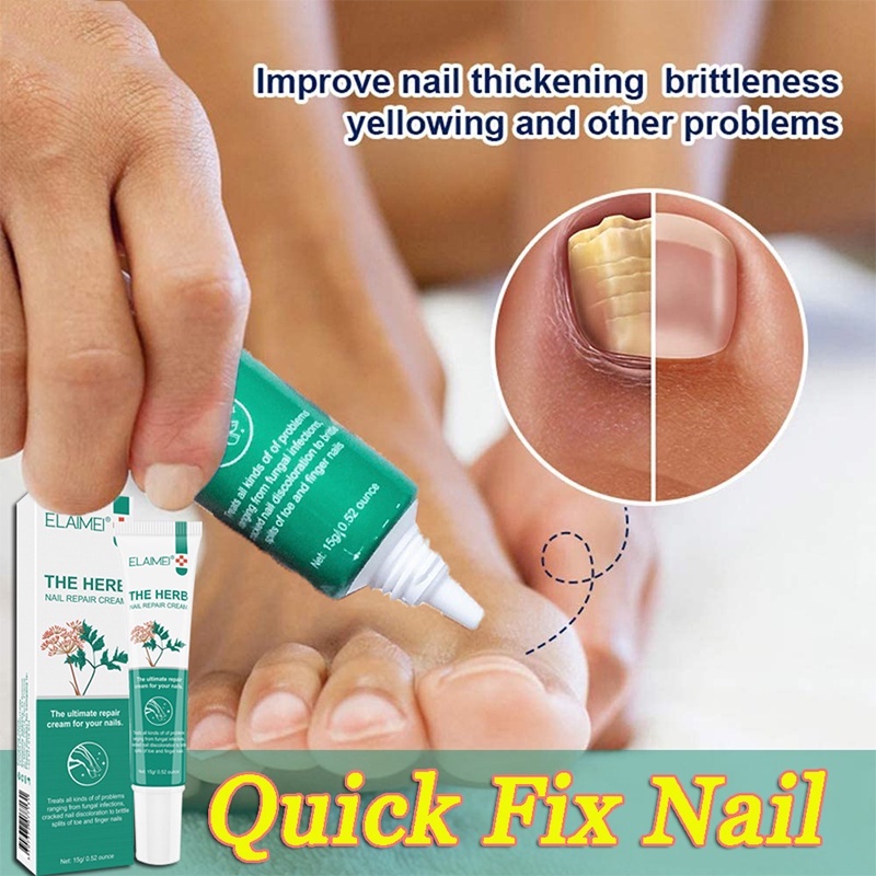 Nail Repair Cream fungus cream Nail Soothing Repair Cream bright