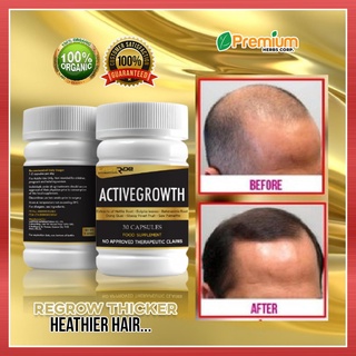 Active Growth Hair Grower Hair Growth Castor Oil Novu Hair Minoxidil ...