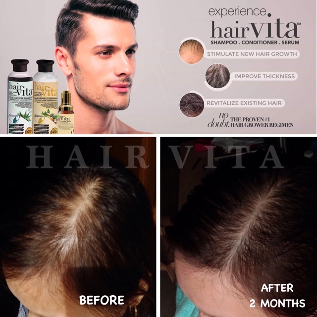 ORIGINAL Hair Vita Hair Grower Set | Shopee Philippines