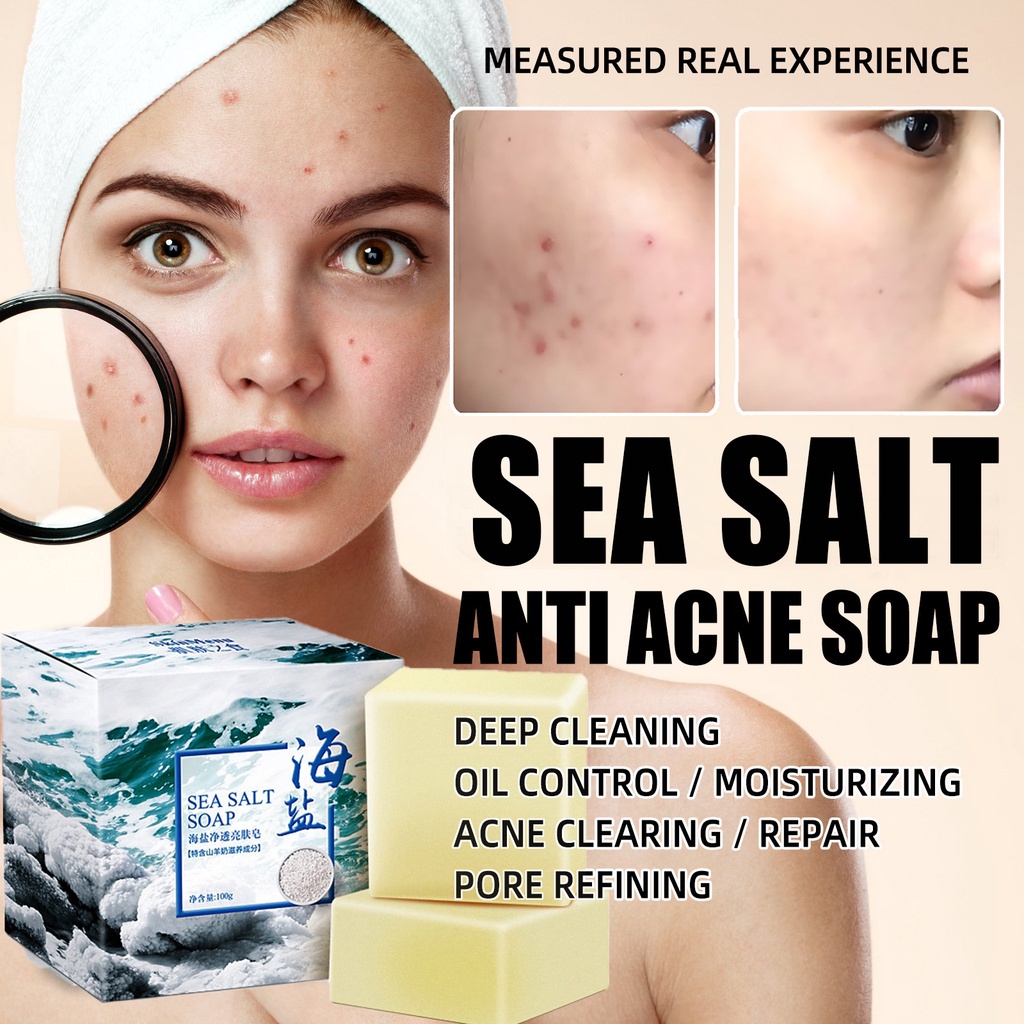 Sea Salt Soap Removal Pimple Acne Treatment Mite Removal Soap Itching