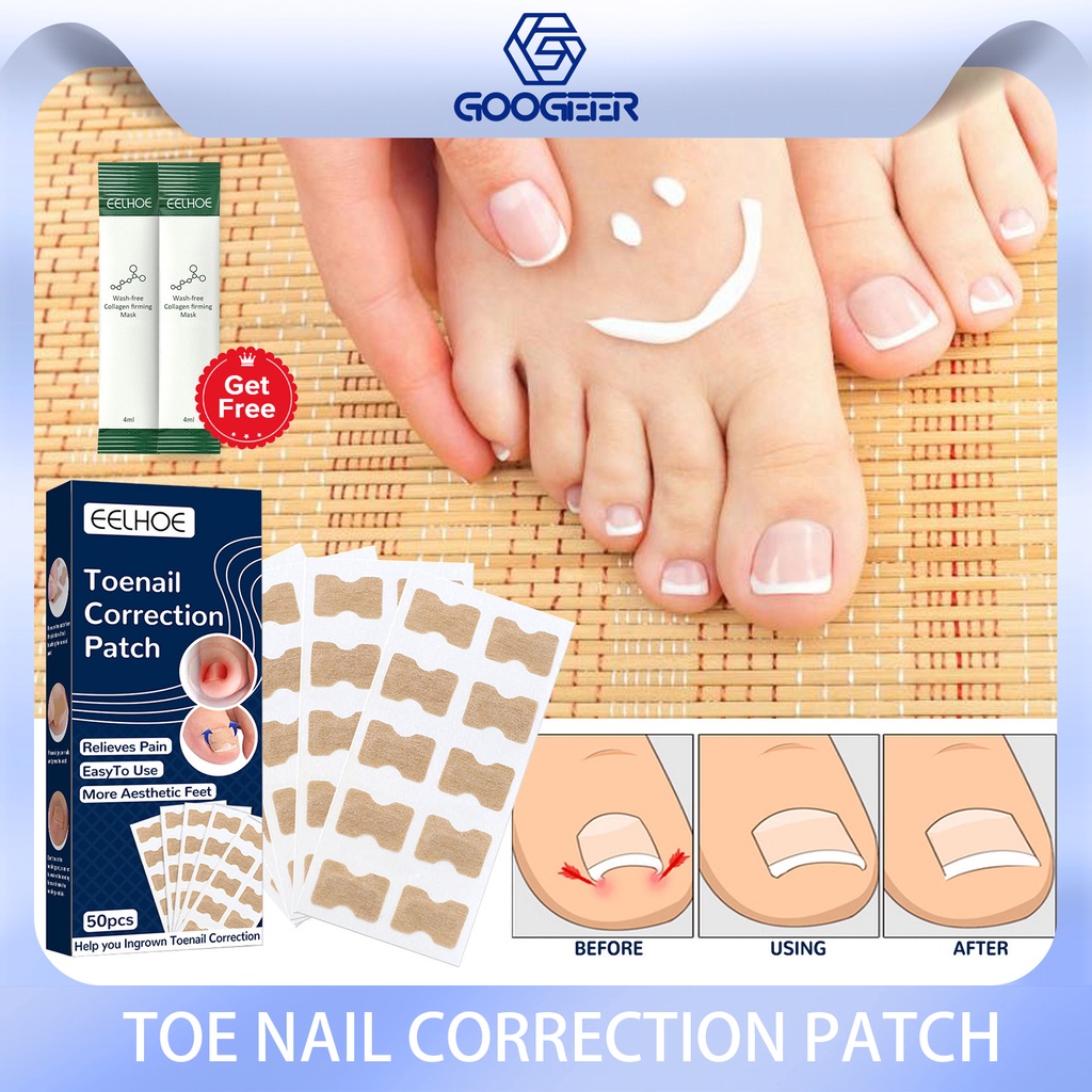 EELHOE Nail correction stickers NonGlue Toenail Patch Ingrown Toenail