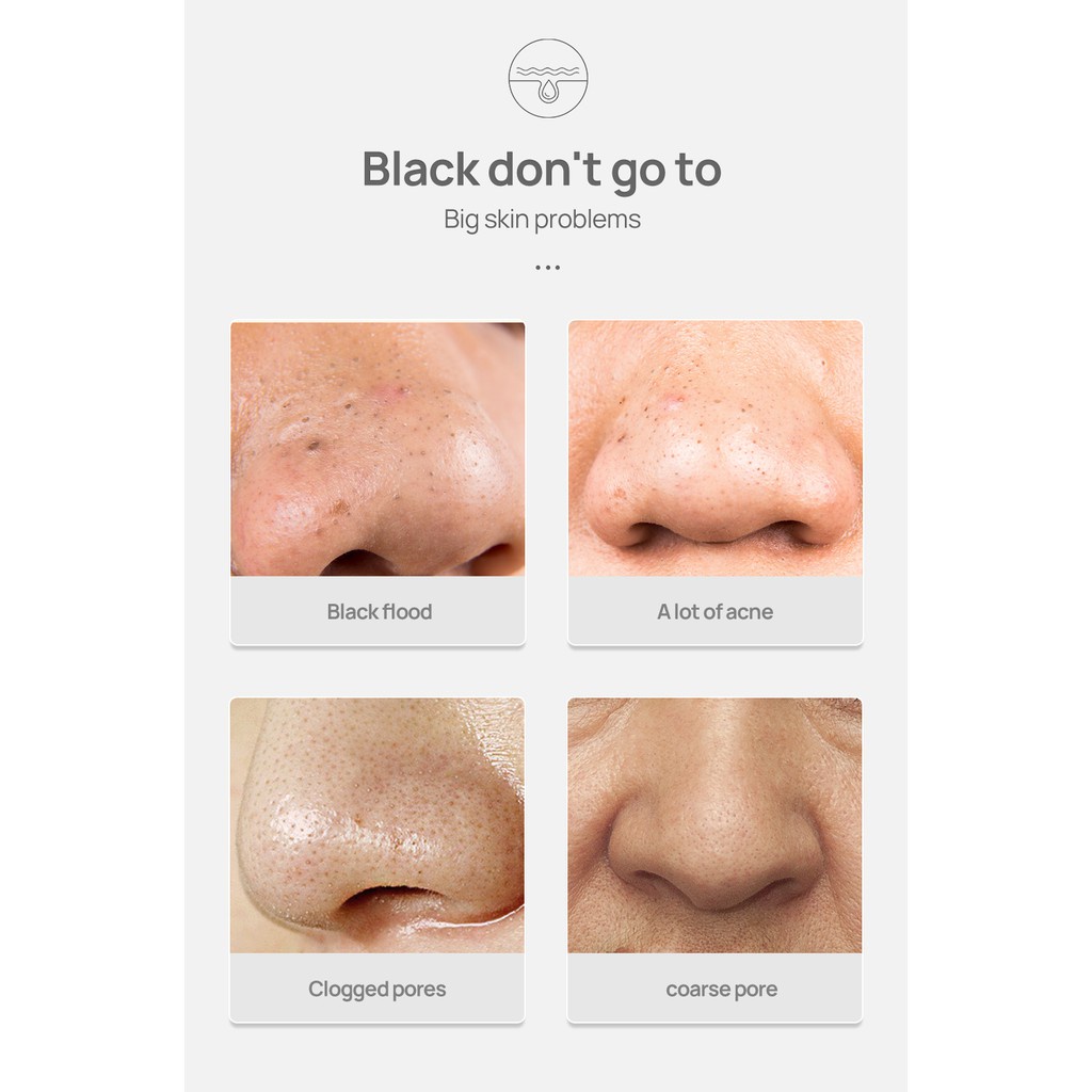 (in stock)LANBENA Black Head Cleansing Cream to Remove Acne Cutin and Repair Pore Facial Mask/30g