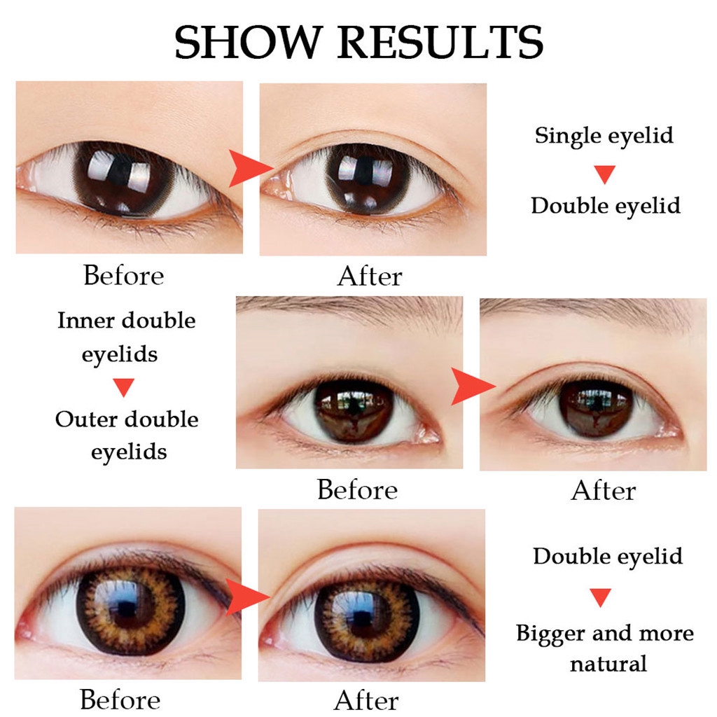 Single eye. Single eyelid. Single vs Double eyelid. Single-Edged eyelid. Single-eyed.